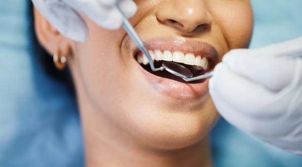 Best Emergency Dental Filling Replacement  in Newburgh, IN